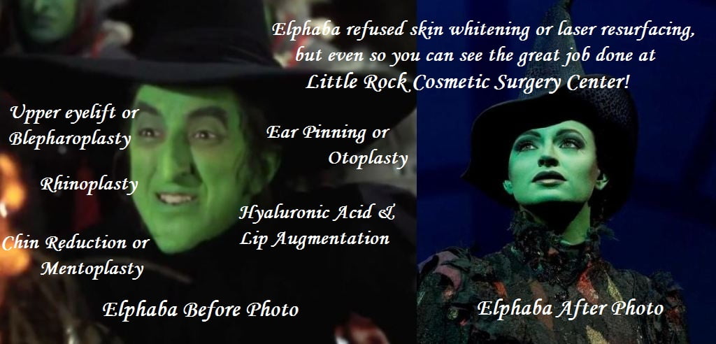 Elphaba Before & After Photo - Little Rock Cosmetic Surgery